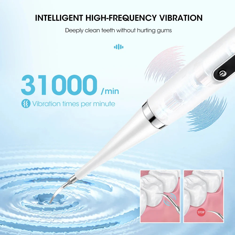 Tandsteen Verwijderaar - Elektrische Sonic Reiniger voor Perfecte Mondhygiëne